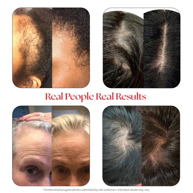 HAIRtamin, Сыворотка для кожи головы, 60 мл (2 жидк. Унции)